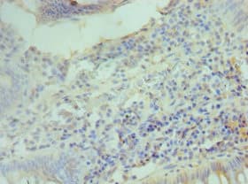 CCND2 / Cyclin D2 Antibody (aa1-289)