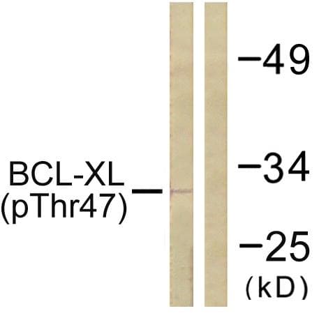 BCL2L1 / BCL-XL Antibody (phospho-Thr47)