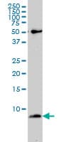 IHC-plus™ ATP5E Antibody (clone 2F3)