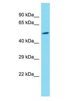 KDM4E Antibody (aa60-109)
