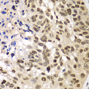 HR6B / UBE2B Antibody