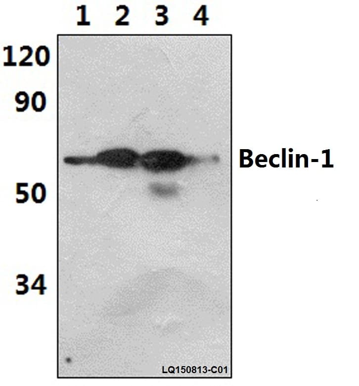 Polyclonal Rabbit anti-Human BECN1 / Beclin-1 Antibody (Arg238, WB)