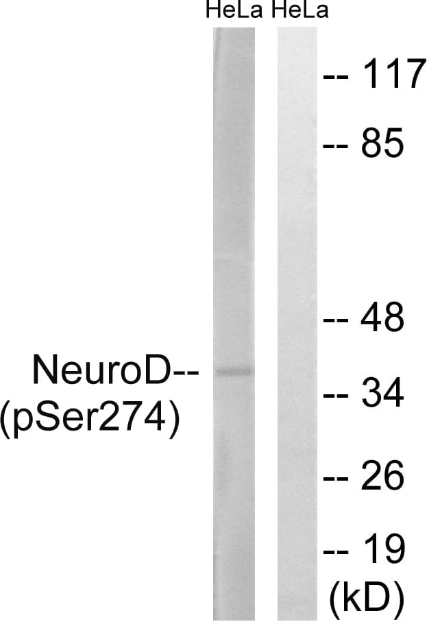 NEUROD1 Antibody (phospho-Ser274)