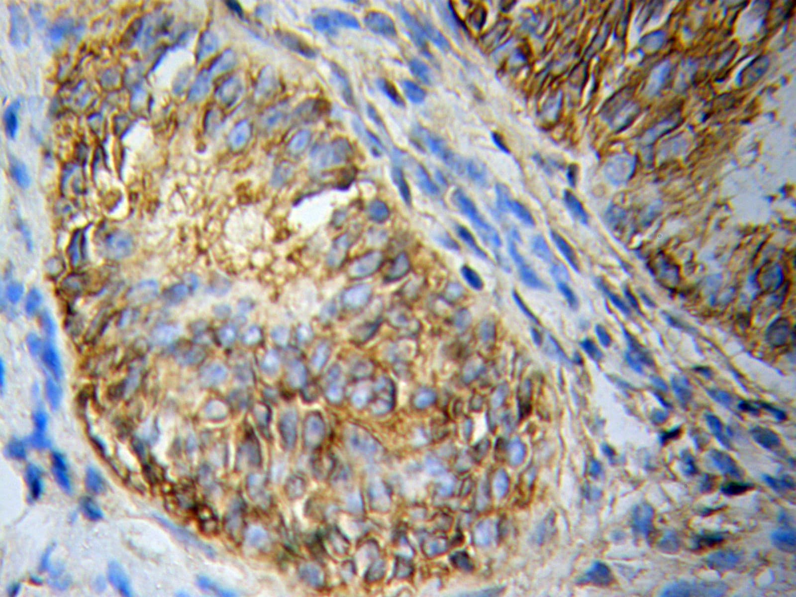 Polyclonal Rabbit anti-Human CASP10 / Caspase 10 Antibody (IHC, WB)