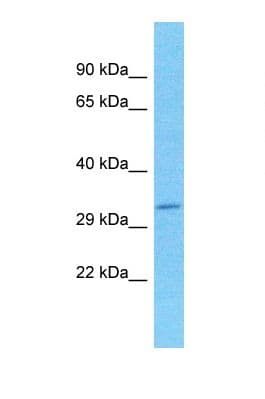 Polyclonal Rabbit anti-Human SPDYC Antibody (N-Terminus, WB)