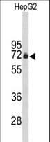 Polyclonal Rabbit anti-Human FBXO3 Antibody (aa395-422, WB)