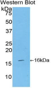 CD27L / CD70 Antibody (aa64-192)