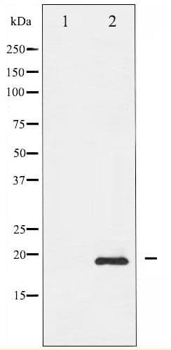BIRC5 / Survivin Antibody (phospho-Thr117)