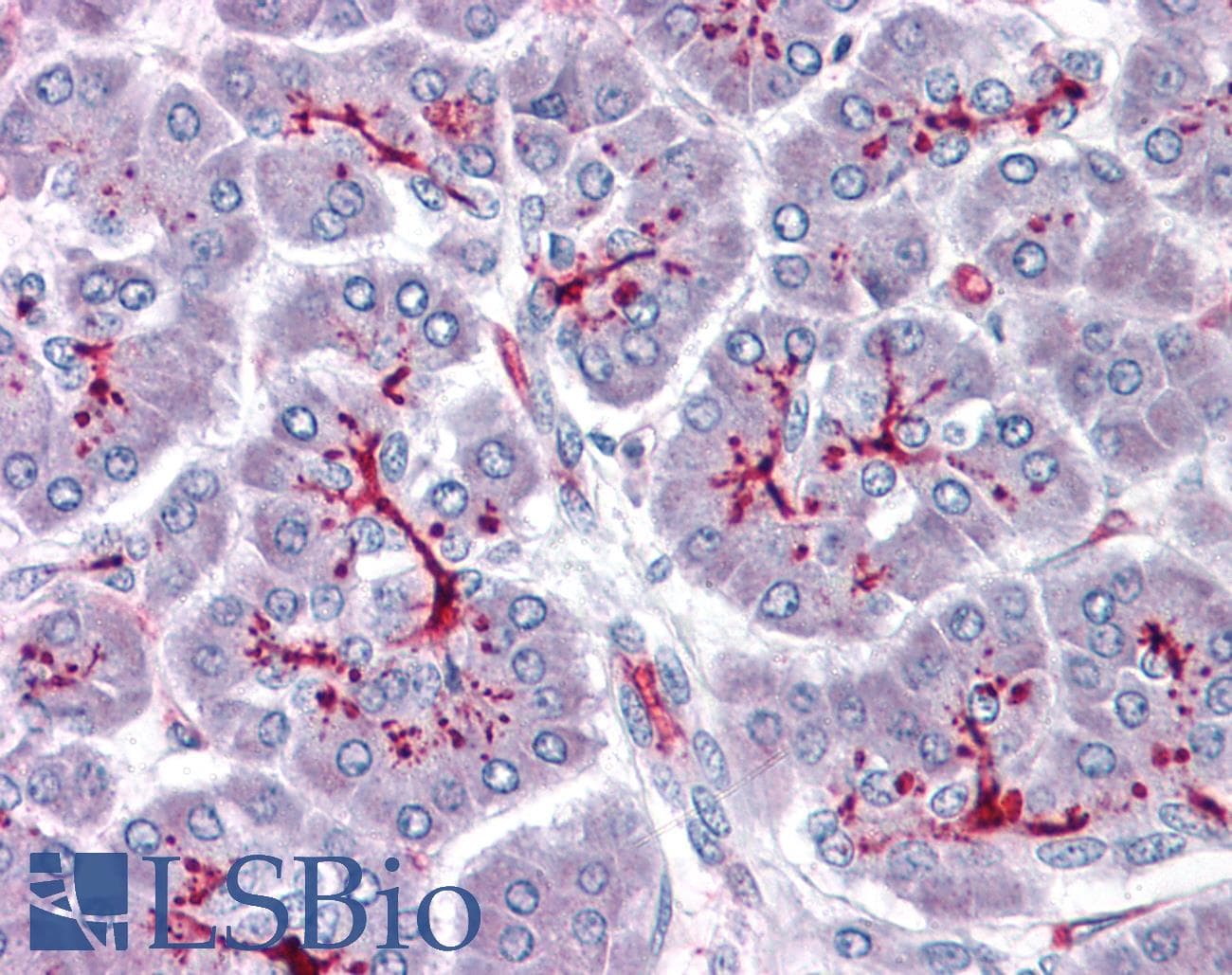 IHC-plus™ Polyclonal Rabbit anti-Human SLAIN1 Antibody (IHC)