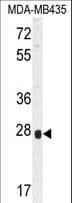 OR8B4 Antibody (aa277-306)