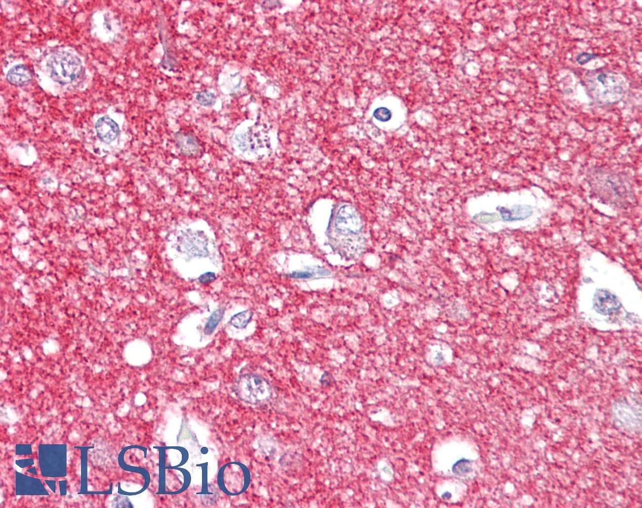 IHC-plus™ Monoclonal Mouse anti-Human AMPH / Amphiphysin Antibody (aa1-347, IHC, WB)