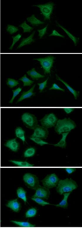 PKM2 Antibody (clone AT1B10)