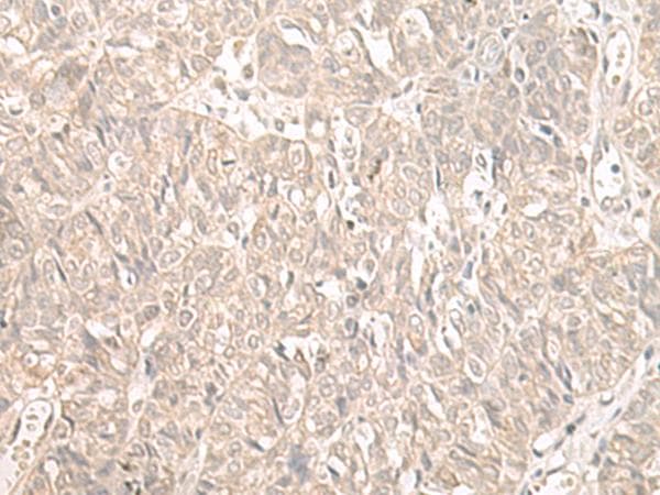 Polyclonal Rabbit anti-Human ILKAP Antibody (IHC, WB)