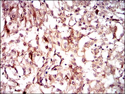 GUCY1A1 / GUCY1A3 Antibody (aa22-214, clone 3G6B2)