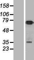 Human NUMB Protein (Over-Expression Lysate Myc-DDK (Flag))