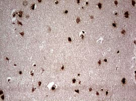 Monoclonal Mouse anti-Human NUMB Antibody (clone OTI2F1, aa1-365, IHC, WB)