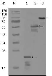 ERBB3 / HER3 Antibody (clone 2B11D11)