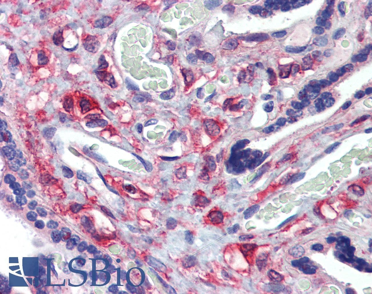 RAB6KIFL / KIF20A Antibody (C-Terminus)