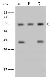 RNMTL1 Antibody