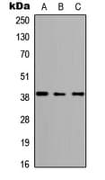 ABHD4 Antibody (C-Terminus)