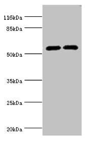 CYP2E1 Antibody (aa49-288)