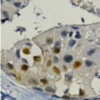 PCNA Antibody