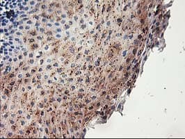 ACSS2 / ACAS2 Antibody (clone OTI3A8)