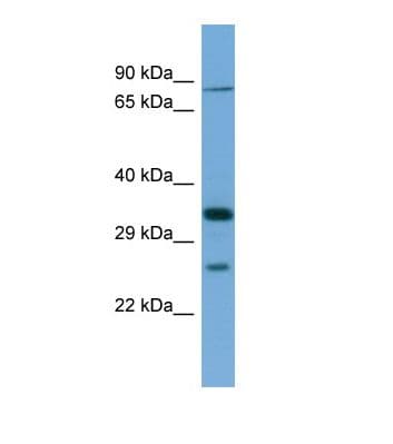 SLC6A9 / GLYT1 Antibody (N-Terminus)