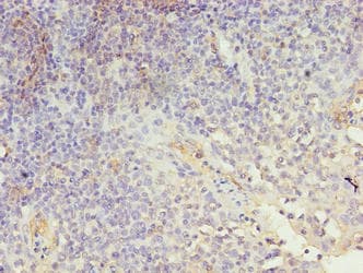 LRRN1 Antibody (aa26-631)