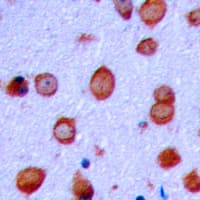 GRIA2 / GLUR2 Antibody (phospho-Ser880)