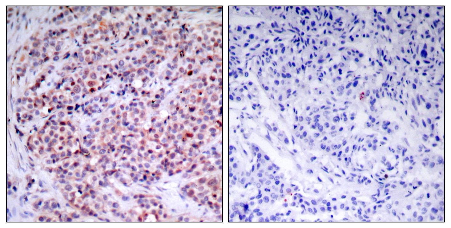 RELA / NFKB p65 Antibody (p435)