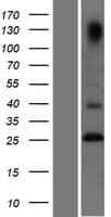 TNFRSF18 / GITR Protein (Over-Expression Lysate Myc-DDK (Flag))
