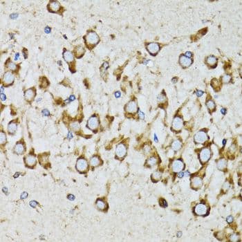 RPN1 / Ribophorin I Antibody