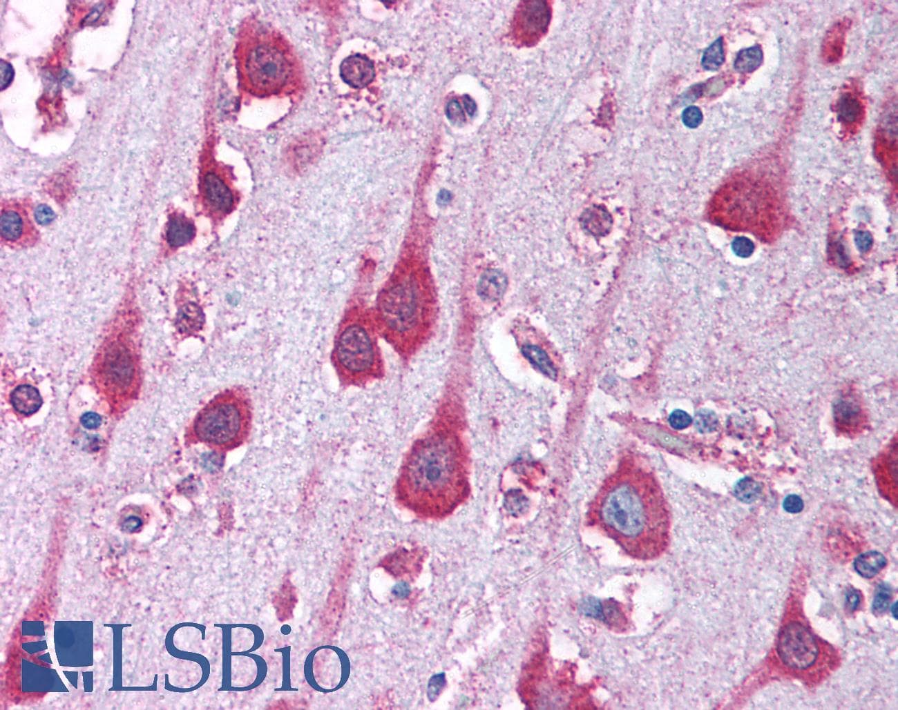 IHC-plus™ Polyclonal Rabbit anti-Human PAK7/PAK5 Antibody (IHC, IF, WB)