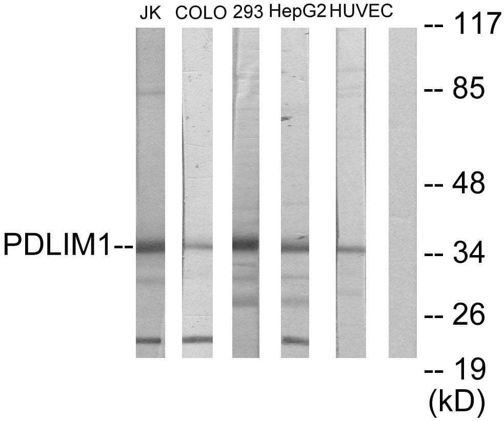 PDLIM1 Antibody