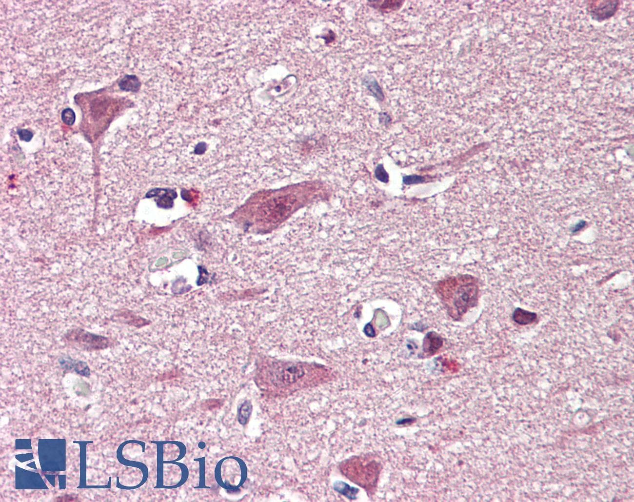 IHC-plus™ Polyclonal Goat anti-Human CHD7 Antibody (aa1865-1877, IHC)