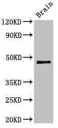 Polyclonal Rabbit anti-Human TMEM49 Antibody (IHC, WB)
