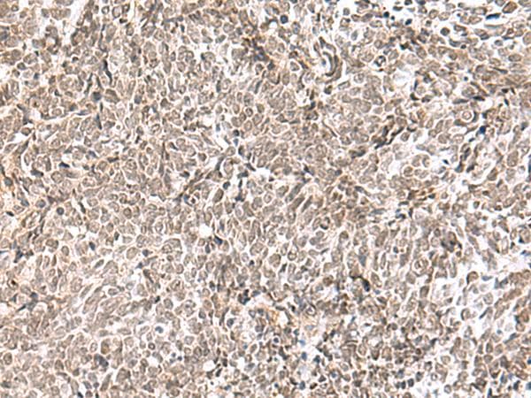 ELAC1 Antibody
