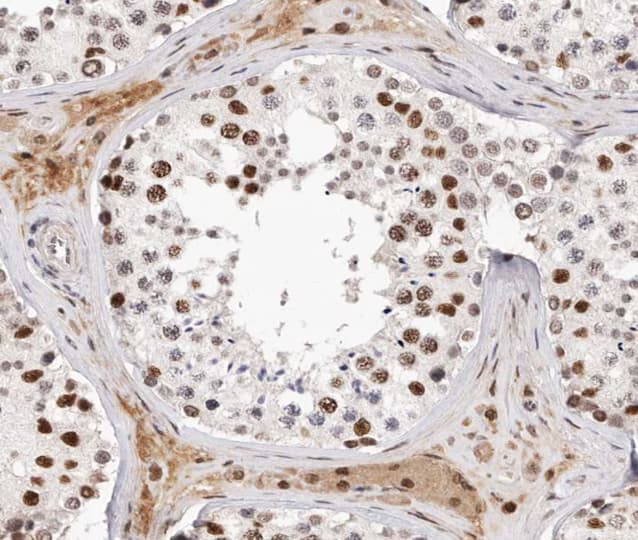 AR / Androgen Receptor Antibody (phospho-Ser650)