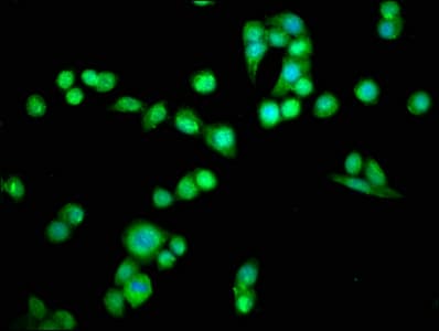 Polyclonal Rabbit anti-Human PDCD6 / ALG-2 Antibody (IHC, WB)