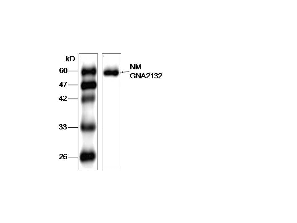 Monoclonal Mouse anti-Neisseria meningitidis Neisseria meningitidis gna2132 Antibody (aa86-282, WB)