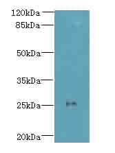 Polyclonal Rabbit anti-Human C11orf53 Antibody (IHC, WB)