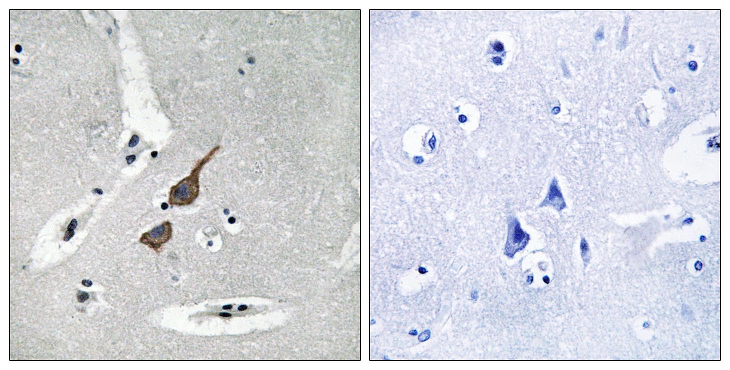 Polyclonal Rabbit anti-Human GRID1 Antibody (IHC, WB)