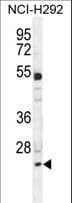 BCL7A Antibody (aa1-30)