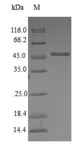 Human CETN3 Protein (Recombinant GST, N-terminus)