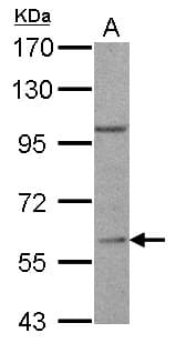 Polyclonal Rabbit anti-Human RGS14 Antibody (aa504-566, IHC, WB)