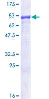 Human IMPDH1 Protein (Recombinant GST)