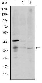 CD1A Antibody (clone 6H3)
