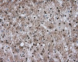 ERCC1 Antibody (clone OTI2H5)