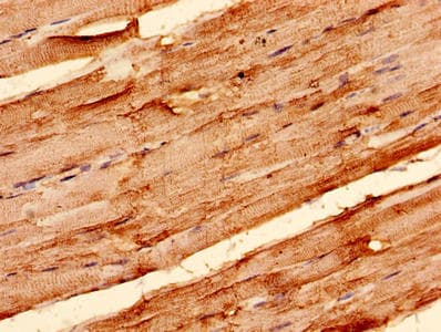 Polyclonal Rabbit anti-Human SLC2A4 / GLUT-4 Antibody (aa223-287, IHC, WB)